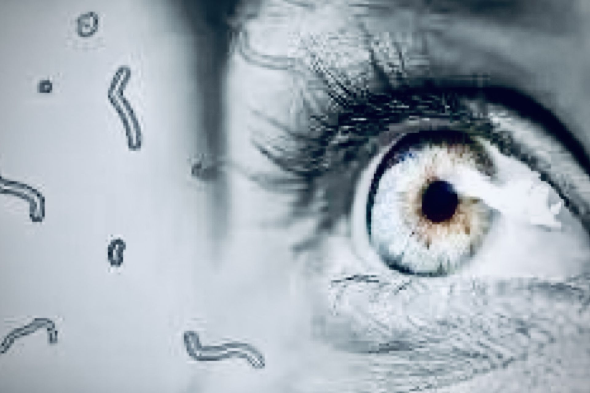 Les myodésopsies ou mouches volantes: phénomène banal ou urgence oculaire?