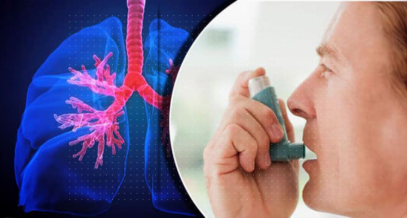 Asthme: le Liban à bout de souffle