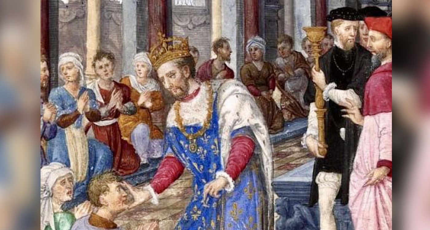 Monarchie sacrée: quand les rois prétendaient guérir par le toucher