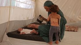 Gaza: la varicelle gagne les camps de déplacés
