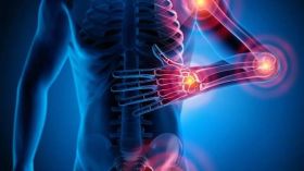 Arthrite: au Liban, reconnaître les signes pour agir plus tôt