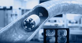 Coloscopie sans endoscope : la capsule-caméra qui voit le côlon