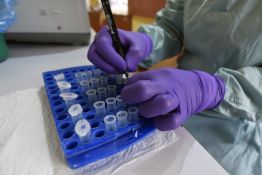 Au Nigeria, le «choc» après l'annonce d'un premier cas d'Ebola de souche Bundibugyo
