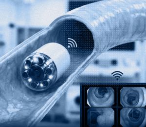 Coloscopie sans endoscope : la capsule-caméra qui voit le côlon