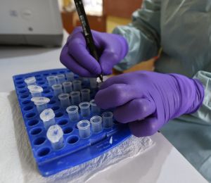 Au Nigeria, le «choc» après l'annonce d'un premier cas d'Ebola de souche Bundibugyo