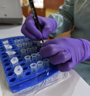 Au Nigeria, le «choc» après l'annonce d'un premier cas d'Ebola de souche Bundibugyo