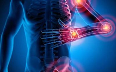 Arthrite: au Liban, reconnaître les signes pour agir plus tôt