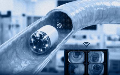 Coloscopie sans endoscope : la capsule-caméra qui voit le côlon
