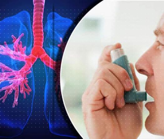 Asthme: le Liban à bout de souffle