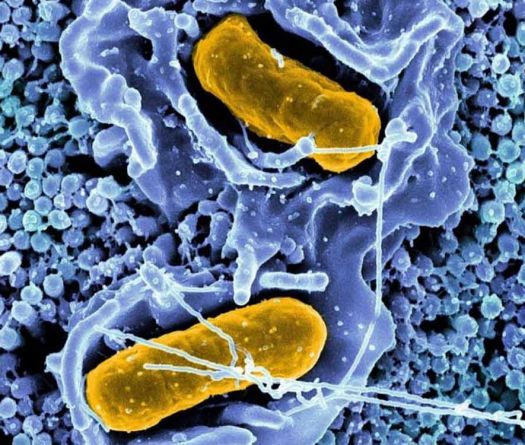 Salmonelle et typhoïde au Liban: faut-il s’inquiéter cet été?