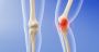 Smart Cartilage: The New Frontier Against Arthritis?