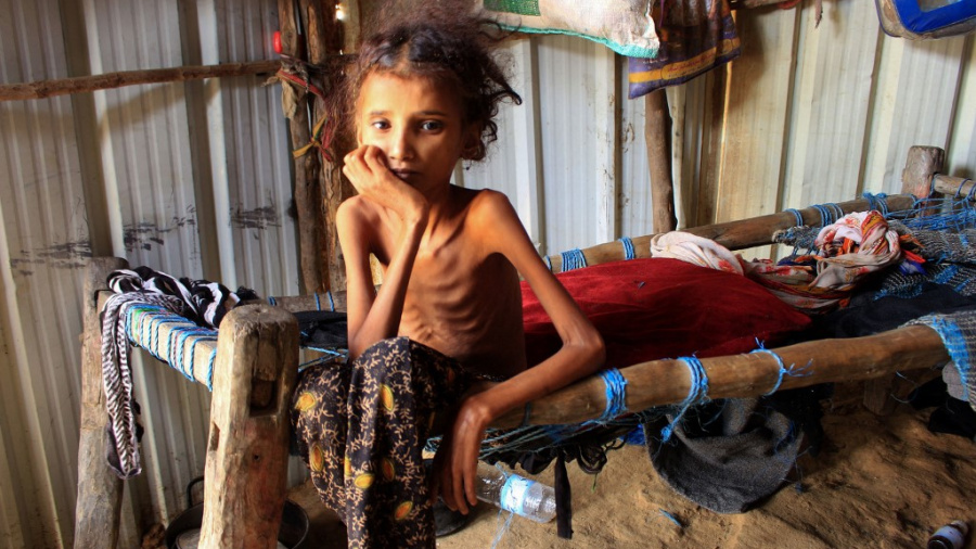 Désespérée, l'ONU réduit l'aide alimentaire au Yémen faute de fonds