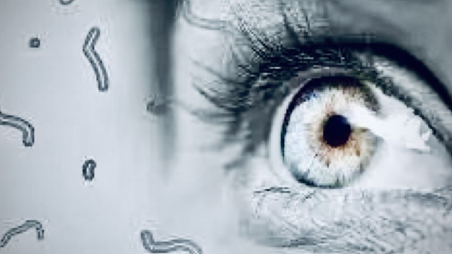 Les myodésopsies ou mouches volantes: phénomène banal ou urgence oculaire?