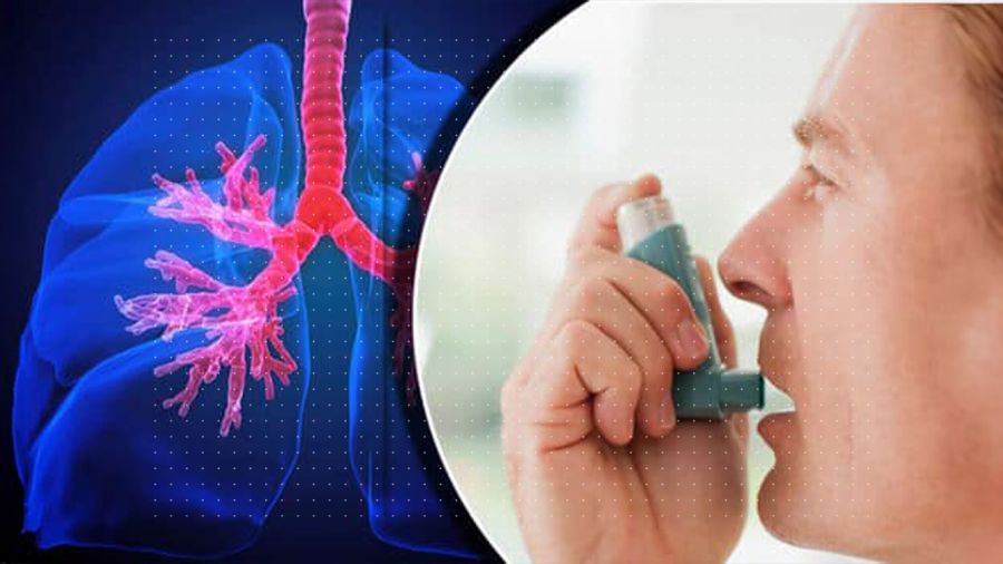 Asthme: le Liban à bout de souffle