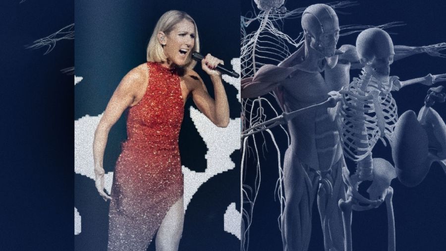 Céline Dion à Paris: quand la scène révèle le syndrome de la personne raide
