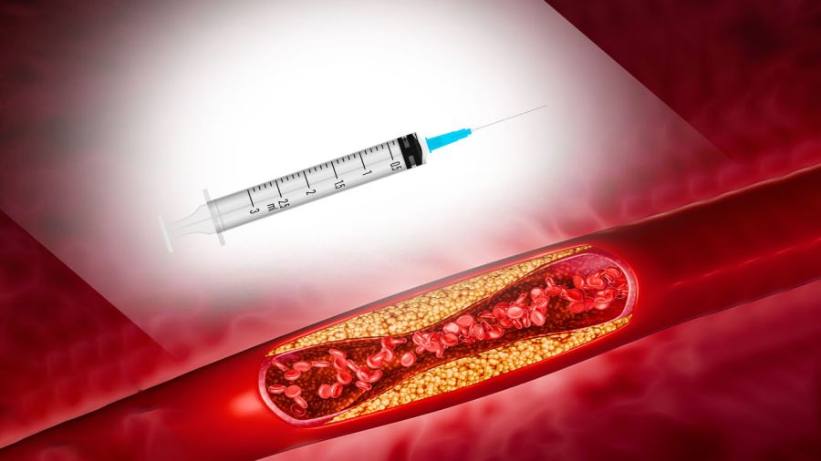 Cholestérol: une injection pour en finir avec les comprimés à vie?
