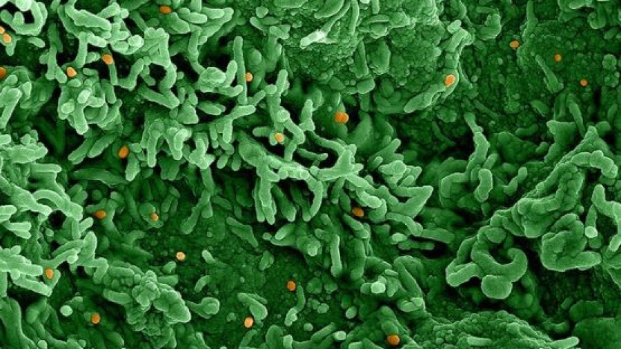 Variole du singe: le contact sexuel, un vecteur important