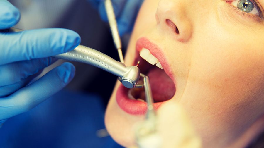 Un vaccin contre les caries? Des chercheurs franchissent un cap