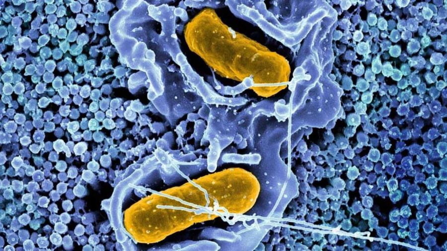 Salmonelle et typhoïde au Liban: faut-il s’inquiéter cet été?
