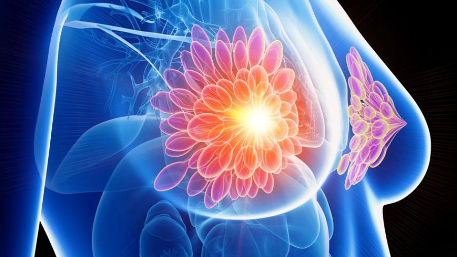 À tout âge, ne jamais sous-estimer le cancer du sein