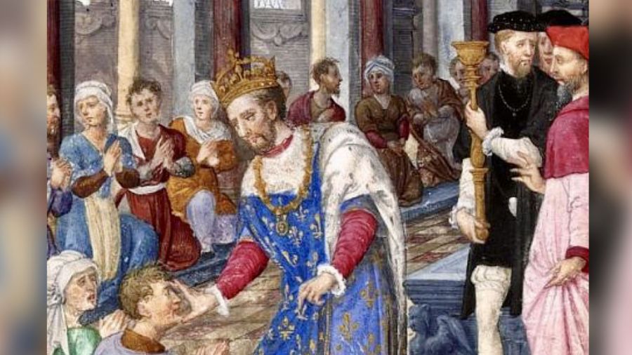 Monarchie sacrée: quand les rois prétendaient guérir par le toucher
