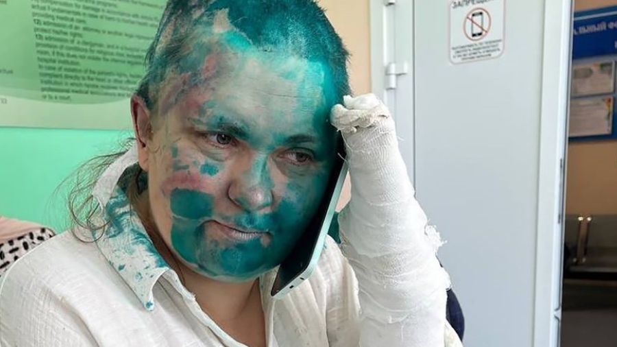 Une journaliste russe violemment battue en Tchétchénie