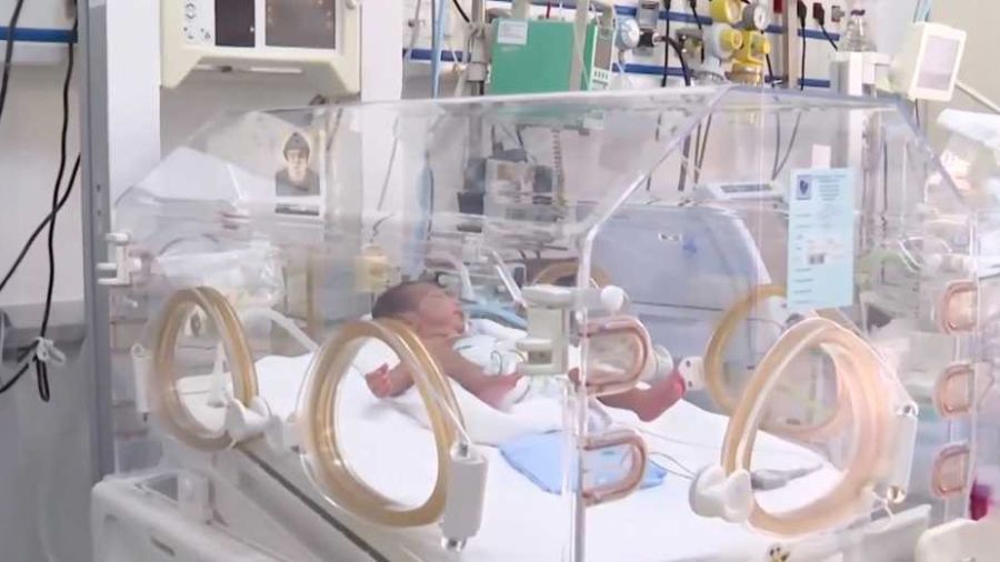 Un prématuré traité d’une malformation cardiaque à l’HDF: une première
