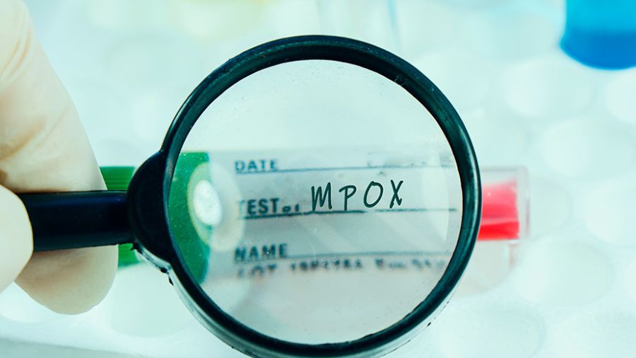 Mpox: une urgence internationale mais (toujours) pas une pandémie