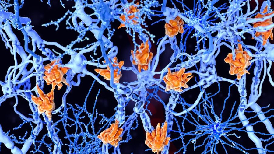 Sclérose en plaques: au Liban, le diagnostic n’est que le début du parcours