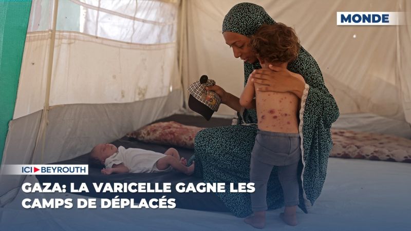 Gaza: la varicelle gagne les camps de déplacés